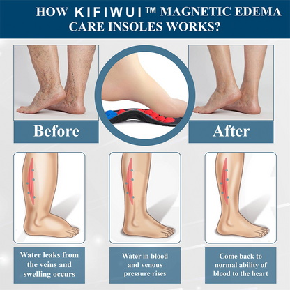 KIFIWUI™ Magnetic EdemaCare Insoles(新西兰）