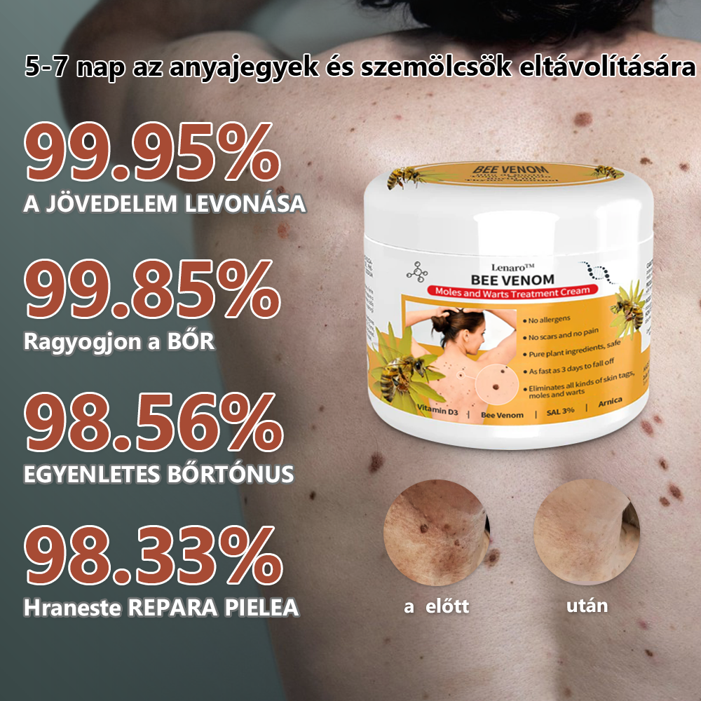 【Hivatalos márkabolt】 Lenaro™ méhméreg vakond- és szemölcskezelő krém (👨‍⚕ESDR AJÁNLJA)