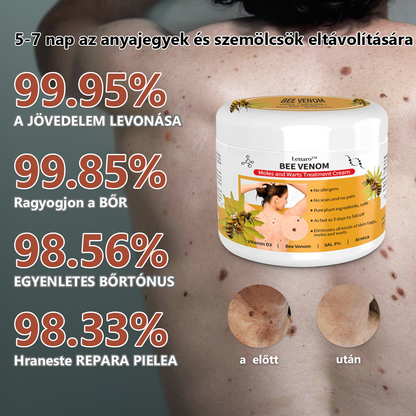 【Hivatalos márkabolt】 Lenaro™ méhméreg vakond- és szemölcskezelő krém (👨‍⚕ESDR AJÁNLJA)